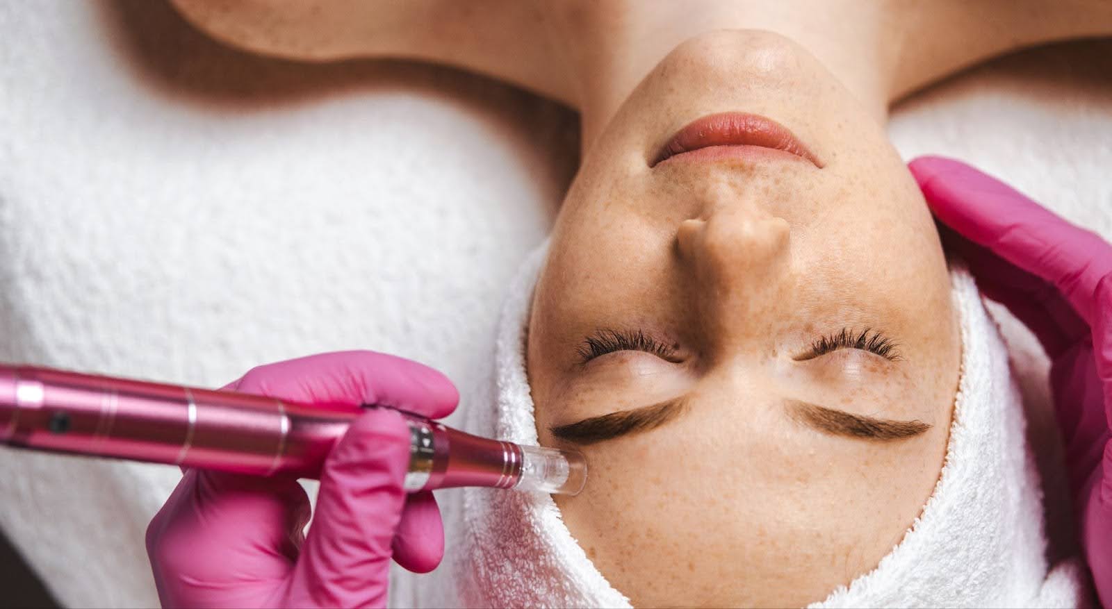 Microneedling and Collagen Induction Therapy
